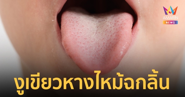 หนูน้อยเคราะห์ร้ายถูก งูเขียวหางไหม้ฉกลิ้น รักษาอยู่ห้อง ICU ใส่เครื่องช่วยหายใจ