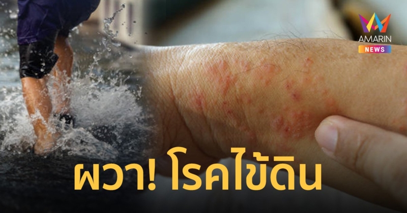 4 จังหวัดอีสานล่าง ผวา! โรคไข้ดิน ปีนี้ป่วยเกือบ 600 ราย ดับแล้ว 6 ราย