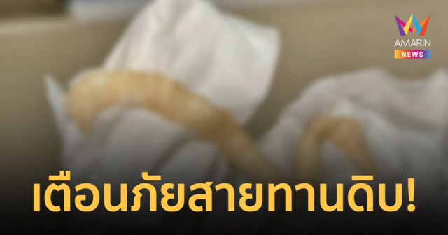 เตือน! คนชอบทานเนื้อดิบ หมอยกเคสเจอ “พยาธิตัวตืด” ปนมากับอุจจาระ