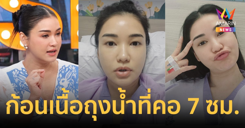 "ชมพู่ ก่อนบ่าย" อัปเดตหลังผ่าตัดก้อนเนื้อถุงน้ำที่คอ ขนาด 7 เซนติเมตร