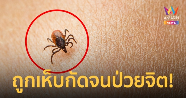 ช็อก! บาทหลวงเฉือนองคชาตตัวเองขาด คาดถูกเห็บกัดป่วยไข้สมองจนเป็นโรคจิต