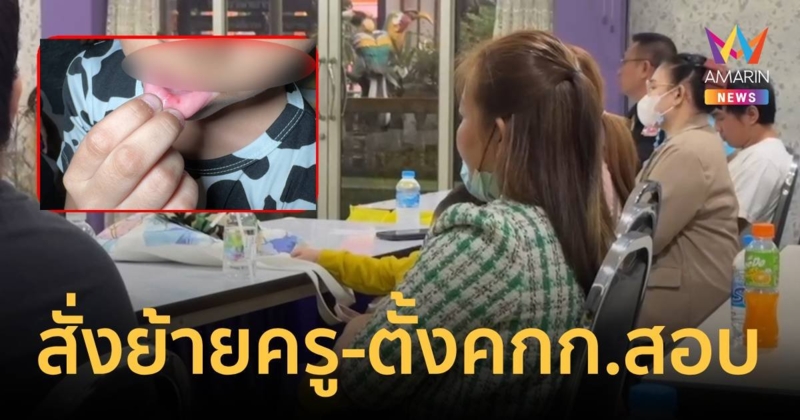 สพฐ.สั่งย้าย “ครู” ลงโทษนักเรียน 36 คน ด้วยการเอาเข็มจิ้มปาก