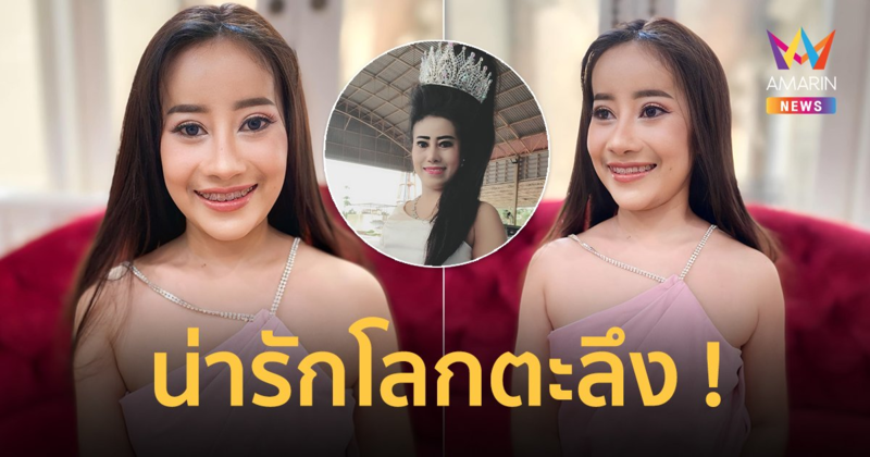 “หนูรัตน์” อวดหน้าใหม่ หลังตัดขากรรไกร สวยหวานละมุนจนจำแทบไม่ได้