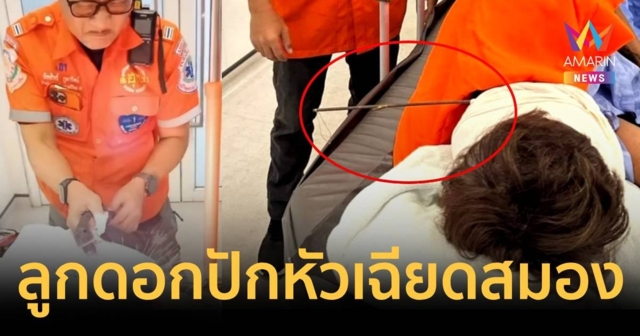 เฉียดสมอง หนุ่มใหญ่ถูกเพื่อนวงเหล้าใช้ลูกดอกยิงเข้าท้ายทอยทะลุสันหู