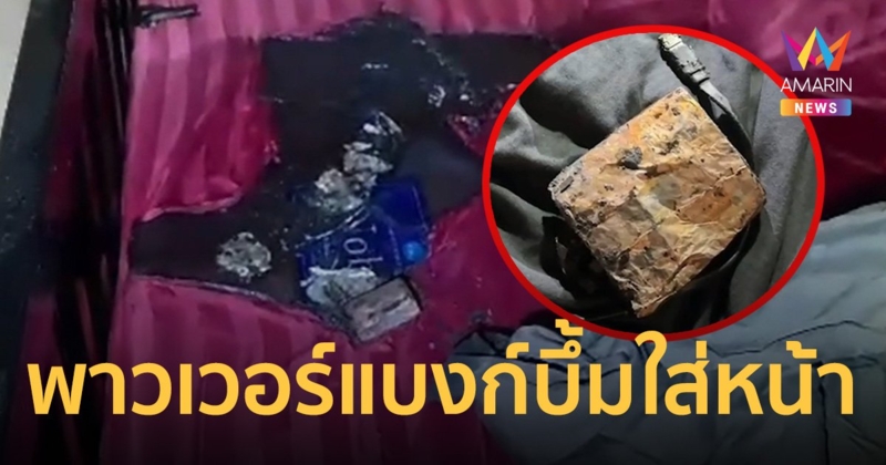 หนุ่มเคราะห์ร้าย พาวเวอร์แบงก์ระเบิดใส่หน้า อุทาหรณ์ชาร์จไฟตอนนอน