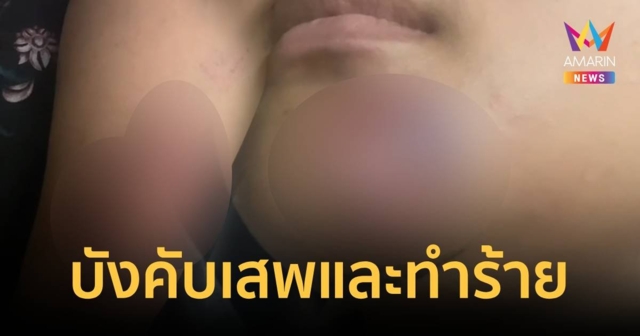 สาว18 ถูกแฟนเพื่อนบังคับเสพยาบ้า-ทำร้าย เหตุโมโหหาว่าพาแฟนสาวไปมีอะไรกับช่างสักยันต์