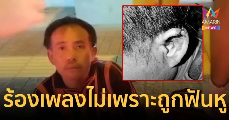 คาราโอเกะเป็นเหตุ! หนุ่มร้องเพลงไม่เพราะ ถูกฟันหูขาด