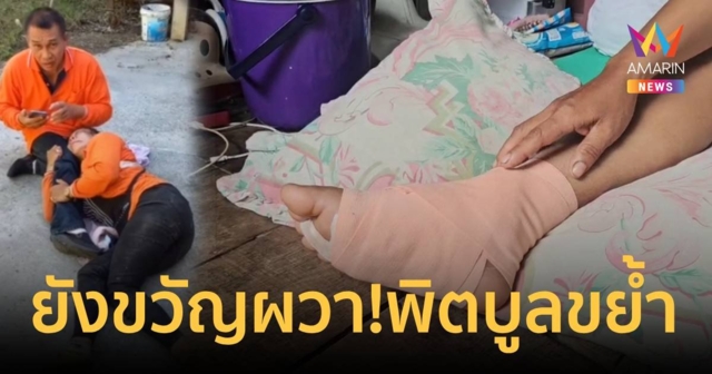 ยังขวัญผวา!เปิดใจพนักงานสาวถูกพิตบูล 2 ตัวรุมขย้ำ