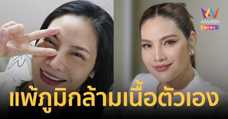 "อรอนงค์ ปัญญาวงศ์" รักษามะเร็งหายแล้ว แต่ตรวจเจอโรคใหม่ "แพ้ภูมิกล้ามเนื้อตัวเอง"