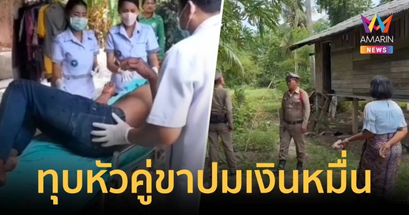 หนุ่ม 37 ถูกแฟนหนุ่มคู่ขาทุบหัวแตก ปมผูกพร้อมเพย์เตรียมรับเงินหมื่้น