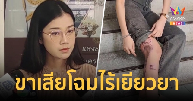 สาวพริตตี้ร้อง ถูกกระบะตู้ทึบชนเสียโฉม รักษาร่วมล้าน ไร้เยียวยา