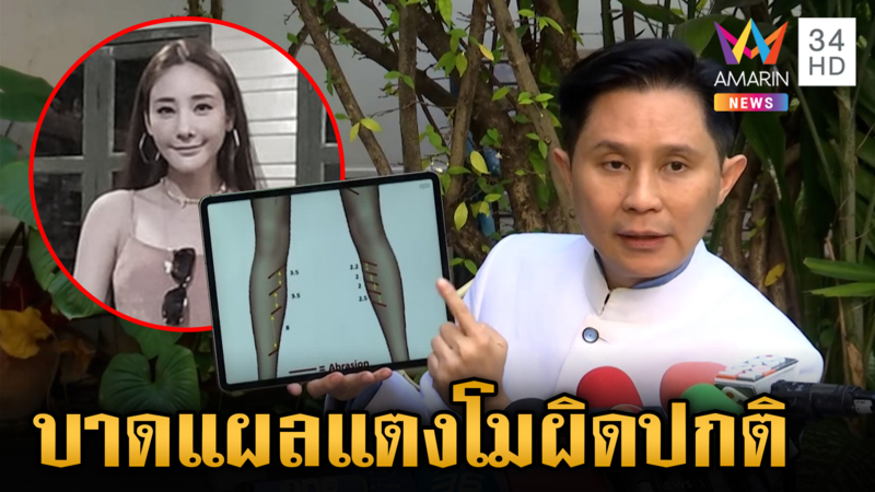 "ปานเทพ" เปิดหลักฐานจับโป๊ะคดีแตงโม เผยความผิดปกติของบาดแผล