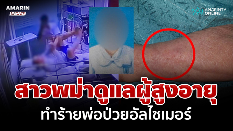 พ่อป่วยอัลไซเมอร์ ถูกพนักงานสาวพม่าในศูนย์ดูแลผู้สูงอายุทำร้าย