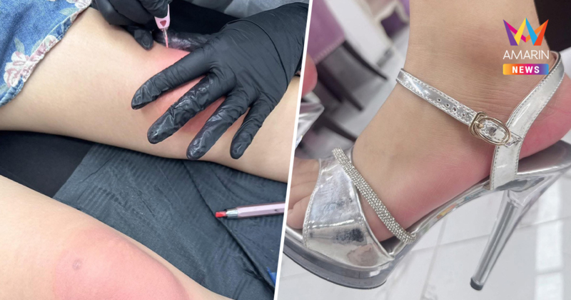 โซเชียลอึ้ง! เทรนด์ใหม่สุดแปลก สักหัวเข่า-ส้นเท้าชมพูลุคคุณหนูสุขภาพดี