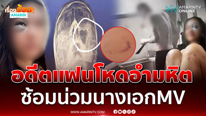 อดีตแฟนโหดซ้อมน่วมนางเอกMV