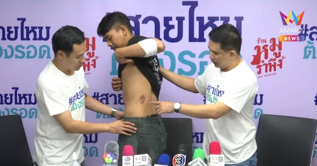 เจ็บทั้งตัว! หนุ่มไรเดอร์ ถูกเก๋งคลั่งไล่ชนกลางถนน