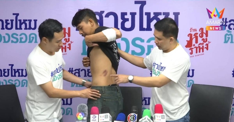 เจ็บทั้งตัว! หนุ่มไรเดอร์ ถูกเก๋งคลั่งไล่ชนกลางถนน