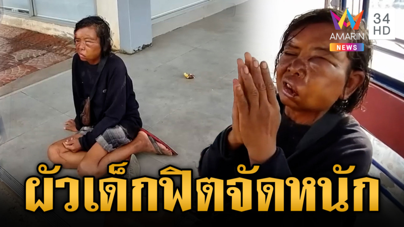 ป้า 53 ทนไม่ไหว ผัวเด็ก 34 หึงโหด ซ้อมจัดหนักจนหน้าปูดบวม