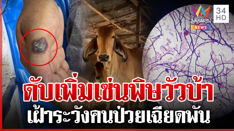เปิดใจหมอตรวจเจอเชื้อ "แอนแทรกซ์" ทำพิษเพิ่มตายสังเวยแล้ว  2 ศพ