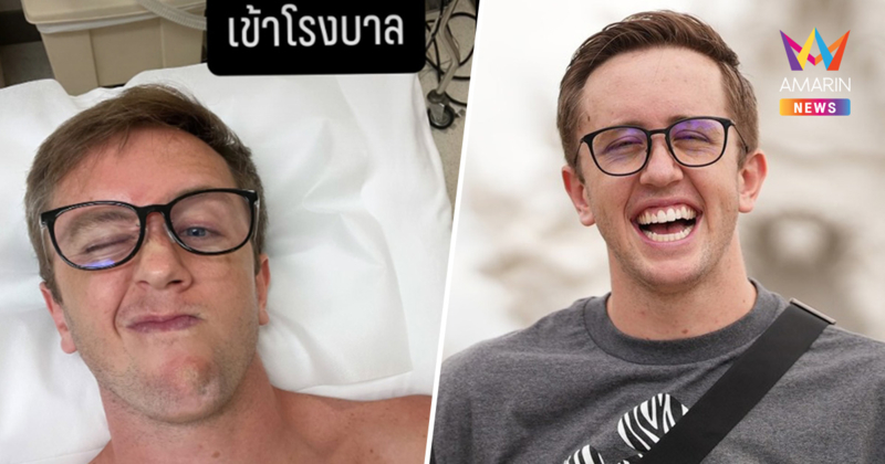 ยูทูบเบอร์ดัง เนท My Mate Nate เข้าโรงพยาบาล ป่วยมะเร็งผิวหนัง