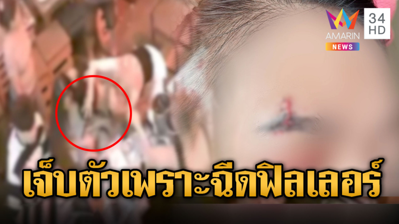 สาวฉีดฟิลเลอร์แต่อยากเที่ยว แค่ปัดชนแก้ว เจอหยุมหัวเจ็บตัวฟรี