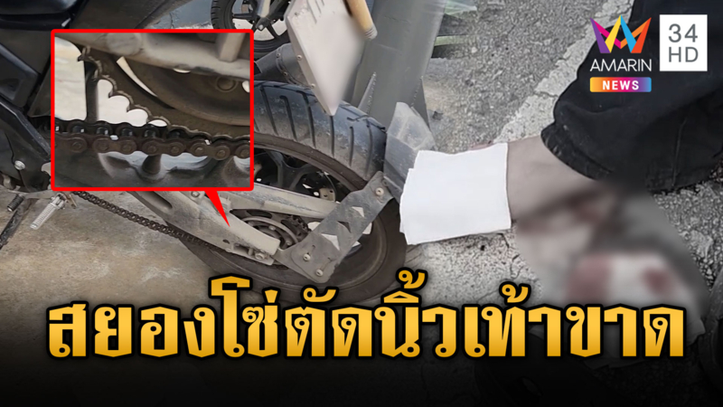 หนุ่มซวย ถูกโซ่จยย.ตัดนิ้วเท้าขาด