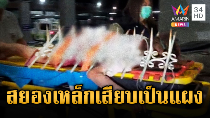 สาว 30 พลัดตกตึก 4 ชั้น รั้วเหล็กเสียบทะลุหลัง