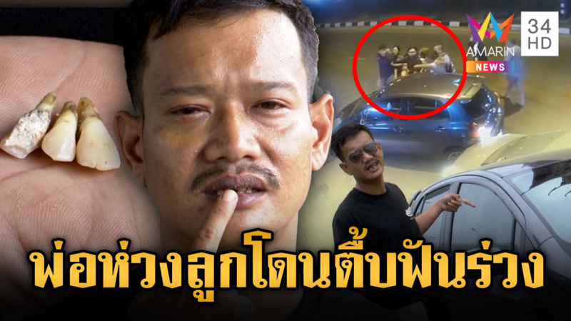 พ่อรีบพาลูกปวดหนักกลับบ้าน ปาดหน้าอริโดนรุมยำฟันหัก 3 ซี่