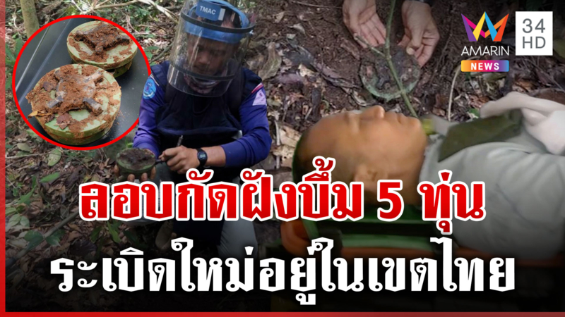 หลักฐานชัดเขมรฝัง PMN-2 ฝั่งไทย 5 ทุ่น สภาพใหม่พร้อมใช้งาน