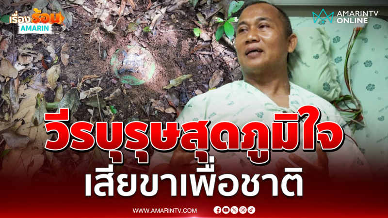 สิบเอกธีรพลลั่นภาคภูมิใจแม้สูญเสียขาซ้ายเพื่อชาติ 