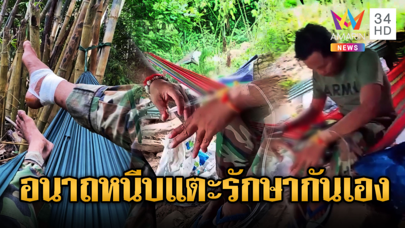 ทหารเขมรชีวิตรันทด หนีบแตะสู้รบ หมอไม่มีรักษากันเอง