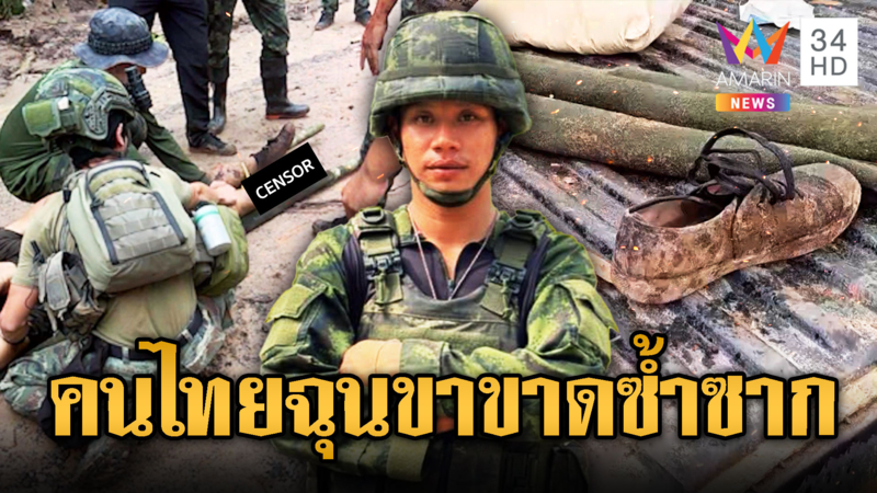 ลอบกัดอีก! ทหารไทยเหยียบระเบิดขาขาดรายที่ 6 รัฐบาลนิ่งเฉย