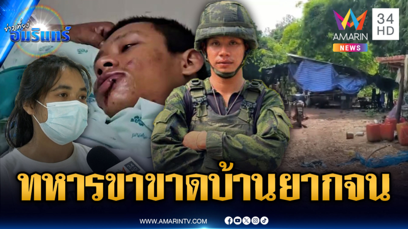 ทหารขาขาดใจสุดเข้มแข็ง ครอบครัวให้กำลังใจ