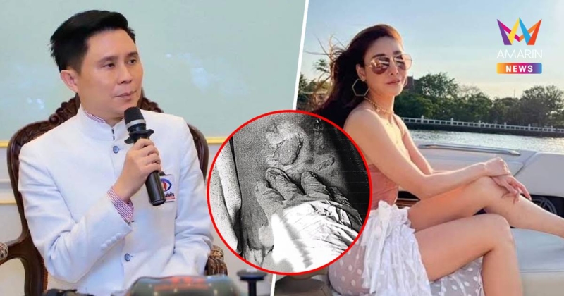 เปิดภาพสำคัญ บาดแผลบนศพ "แตงโม นิดา"