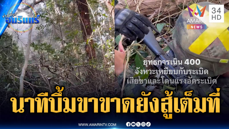 ทหารเหยียบทุ่นระเบิดขาขาด แต่เพื่อนๆ สู้เต็มที่-เขมรขุดบังเกอร์ไม่เลิก