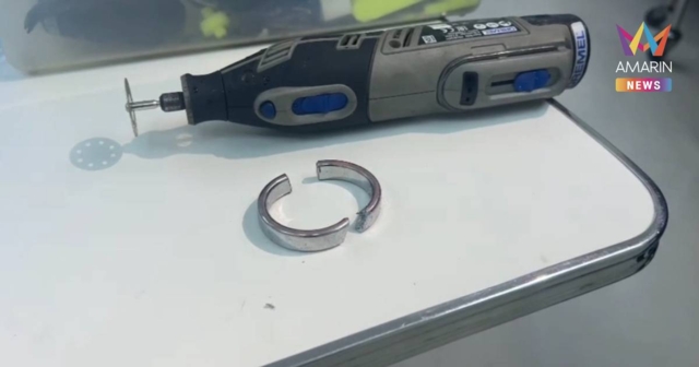 อย่าหาทำ! หนุ่มใหญ่ ใส่ห่วงอวัยวะเพศ หวังใหญ่ สุดท้ายบวมเป่ง