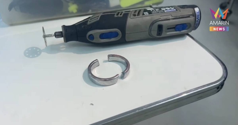 อย่าหาทำ! หนุ่มใหญ่ ใส่ห่วงอวัยวะเพศ หวังใหญ่ สุดท้ายบวมเป่ง