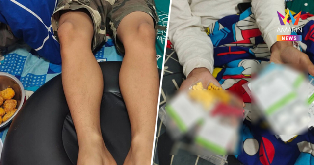 ครูโหดสั่งลุกนั่ง 800 ครั้ง ทำโทษนร.ไม่ส่งงาน หมอสั่งงดเดิน 3 วัน