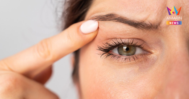 รวมเรื่องน่ารู้สำหรับการผ่าตัดหนังตาตก ศัลยกรรมแก้เปลือกตาหย่อนคล้อย