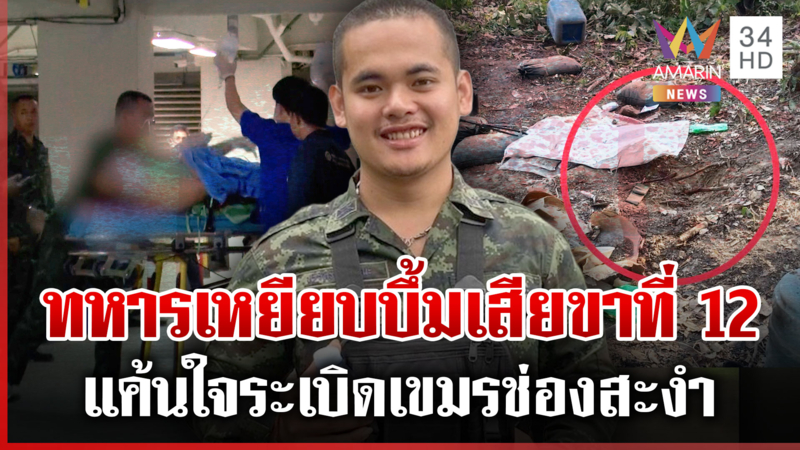ทหารไทยเสียขาที่ 12! เหยียบทุ่นระเบิดเก่าเขมรจุดช่องสะงำ