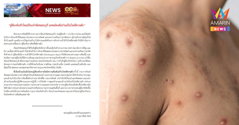 ผวาทั้งคุก นักโทษใหม่ "เรือนจำพิเศษธนบุรี" ติดเชื้อฝีดาษลิง