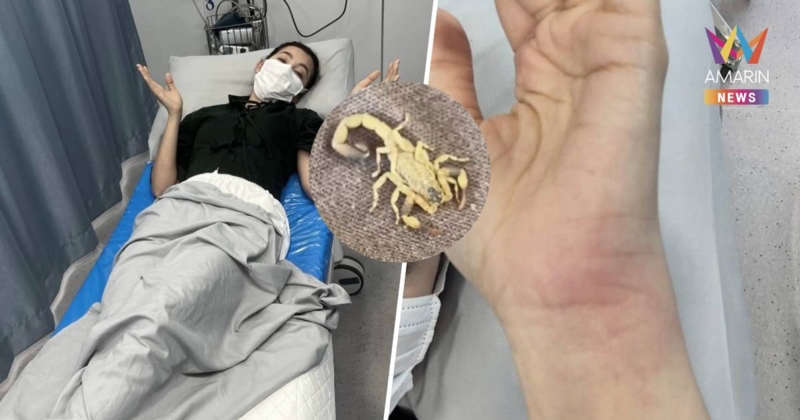 หญิงแกร่ง ! "เบลล่า" เล่า ถูกแมงป่องต่อย 2 จุด พบอยู่ในโจงกระเบน