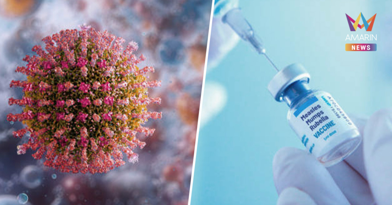 สถานการณ์น่าเป็นห่วง! "โรคหัด" ระบาดพุ่งสูง พบเชื่อมโยงระบาดจากสปป.ลาว