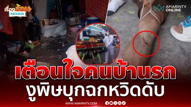 เตือนใจคนบ้านรก งูพิษบุกฉกหนุ่ม หวิดดับสลด