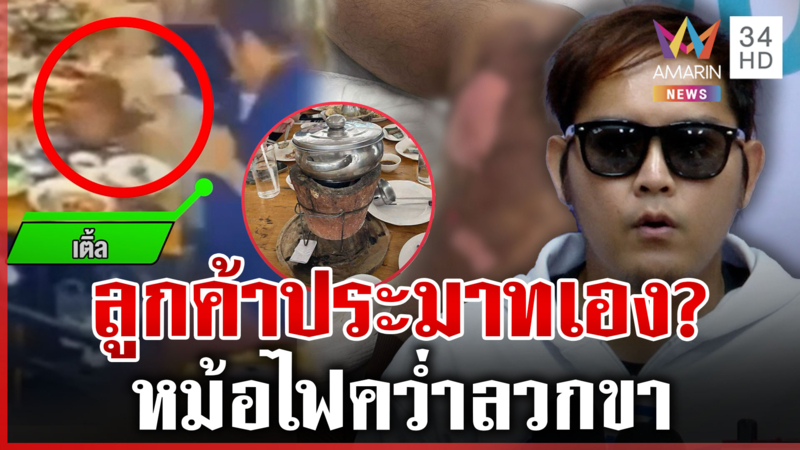 หม้อไฟคว่ำลวกขาไม่รับผิดชอบ ร้านอ้างลูกค้าประมาทเอง