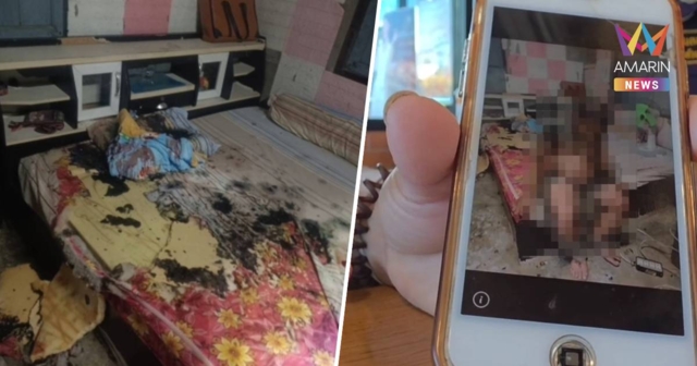 เมียเซอร์ไพรส์วันเกิดผัว สาดน้ำกรด เส้นผมร่วงเนื้อเปื่อยยุ่ย