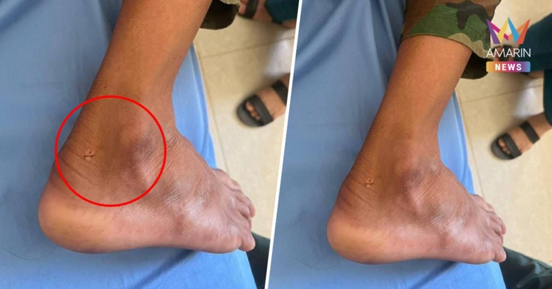 มามุขใหม่! ทหารเขมร อ้างทหารไทย ปล่อยหมาบ้า ไล่งับ เจ็บ 1