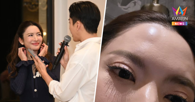 สุดห่วง "แอฟ ทักษอร" เกิดเหตุไม่คาดคิด! FC แห่แซวที่มาหัวปูด