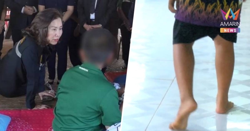 สงสาร! ด.ช.ป.4 ถูกรุ่นพี่แกล้งบิดไข่ จนต้องตัดทิ้ง