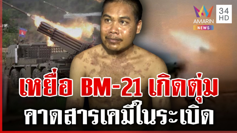 อุบลฯ ระทมหนักเขมรเผาไม่หยุด ช็อกเหยื่อ BM-21 เกิดตุ่มพุพอง